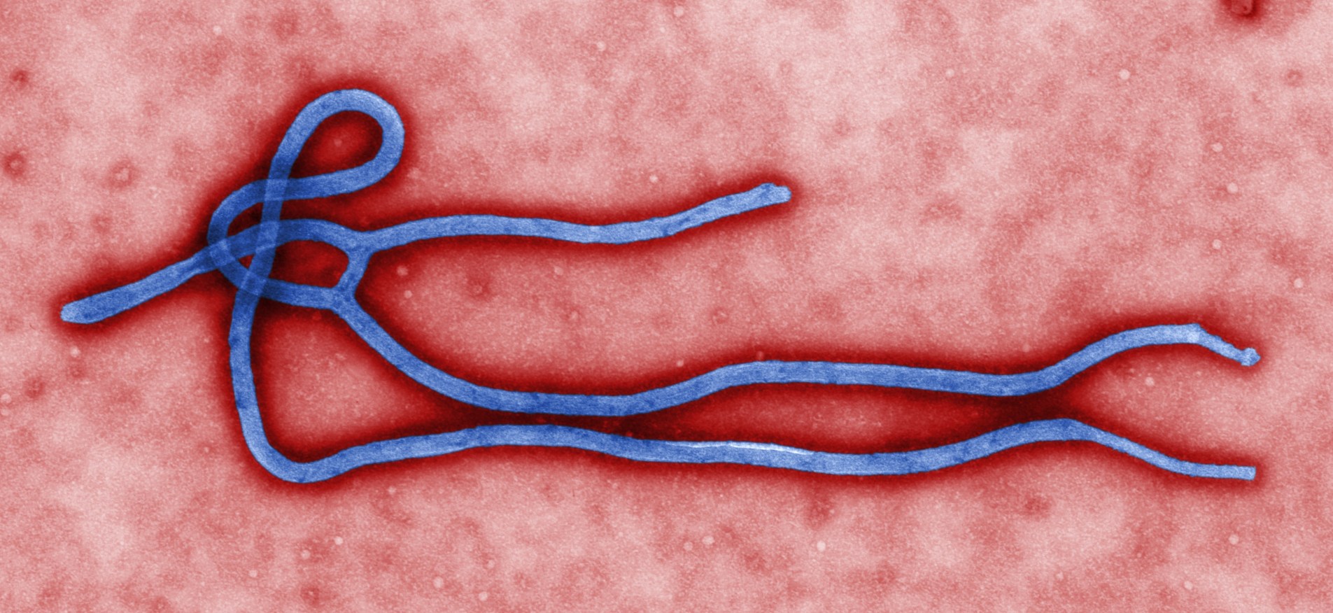 Ebolavirus