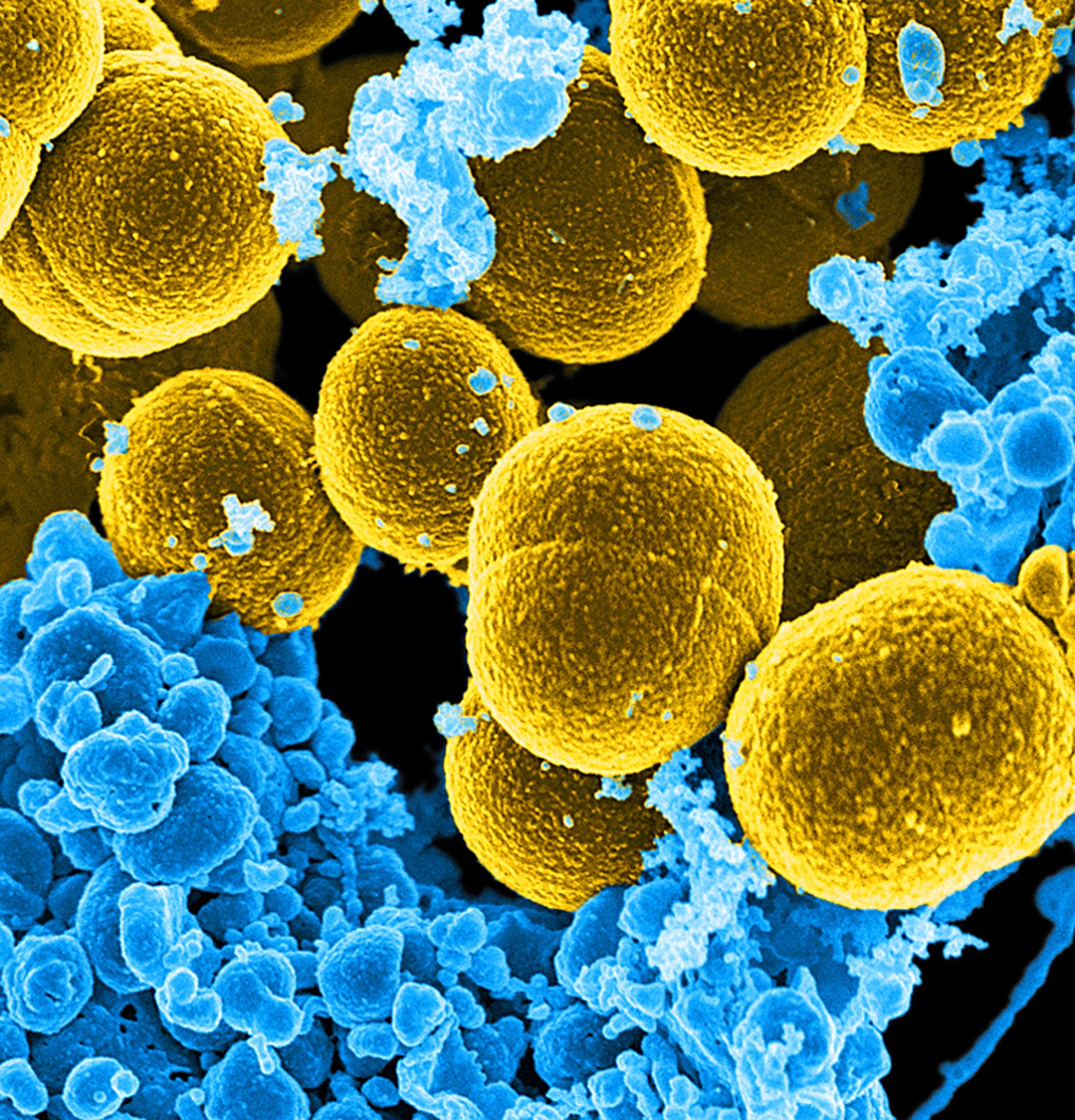 MRSA